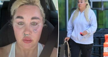 Amanda Bynes shows off shocking new look after undergoing cosmetic procedure