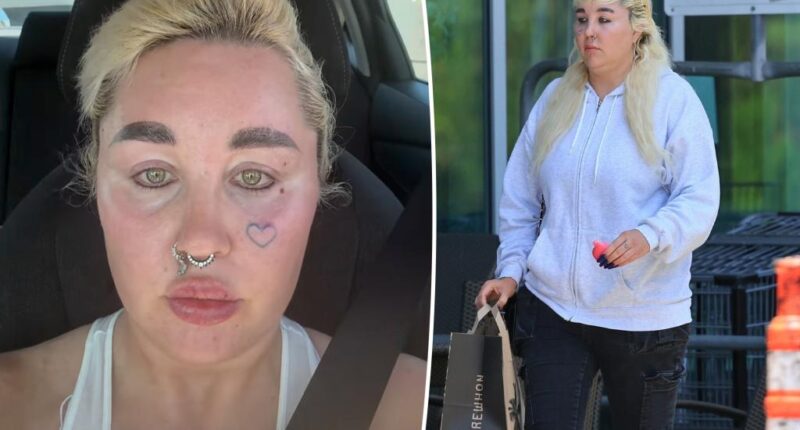 Amanda Bynes shows off shocking new look after undergoing cosmetic procedure