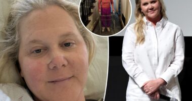 Amy Schumer poses with a walker, reveals she underwent spinal surgery