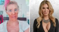 Brandi Glanville Reveals New Smile After $130K Health Battle And Face-Disfiguring Parasite
