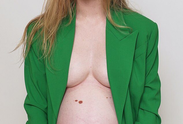 I even arranged the photoshoot, so I could remember how my pregnant body looked with pride, writes Flora Gill