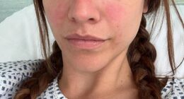 Barbara Palvin opened up about a private health struggle and why she stepped away from the spotlight for several months