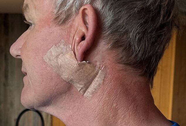 Gordon Ramsay has revealed he suffered a terrifying cancer scare