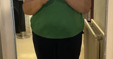 BEFORE: Last summer Claudia Connell weighed in at 13st 2lb, and so she then began her weight-loss journey with Mounjaro jabs