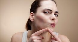 TikTok user Alisha Monaco tried to pop a pimple just below her nose, but ended up in urgent care when the area got infected (stock image)