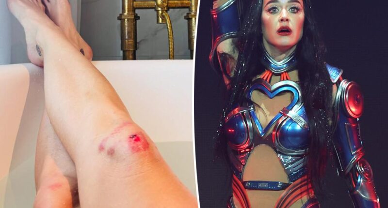 Katy Perry shows off brutally scraped knees she sustained during 'Lifetimes' tour