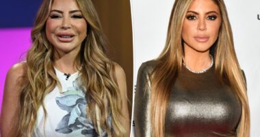 Larsa Pippen blames 'allergic reaction' for shocking face transformation