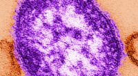 Modelling reveals hundreds of avoidable measles deaths