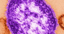Modelling reveals hundreds of avoidable measles deaths