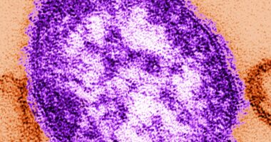 Modelling reveals hundreds of avoidable measles deaths