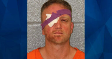 NC Man Gets Kicked Out of Bar for Fighting, Returns With Machete and Brass Knuckles