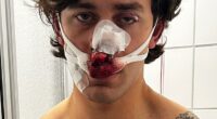 John Rudat (pictured) , 21, was left bloodied and battered after trying to stop two women from being violently assaulted on German public transit