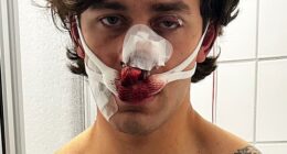 John Rudat (pictured) , 21, was left bloodied and battered after trying to stop two women from being violently assaulted on German public transit