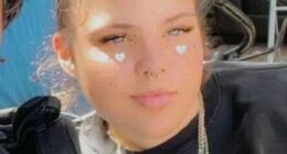 Paris Carpio-Woodley (pictured) had her 'entire head' set on fire after an argument outside a home in Shepparton, in Victoria's north, last year