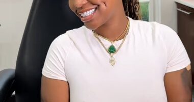 The 'dimpleplasty' is a procedure that creates artificial dimples on a patient's face through intentional scarring - and it's going viral on social media