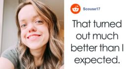 31YO Woman With Dwarfism Who Had Height Surgery As A Teen Stuns Fans With Transformation