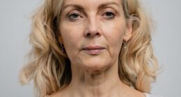 Beauty editor Alice Smellie, who says that despite her efforts, her neck continued to age faster than her face