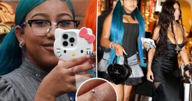 Kim Kardashian blasted for letting daughter North West, 12, get dangerous hand piercing