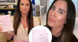 Kyle Richards calls this $20 Medicube face mask a 'miracle'