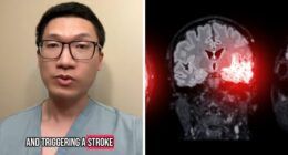 Neurologist Warns Against Popular Post-Exercise Habit That Could Trigger Strokes And Dementia
