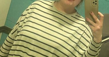 Ellie Jeffries before she lost 12 stone with a gastric sleeve and underwent skin removal surgery