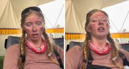 Severely Injured After Everest Climb, 17YO Teen Sparks Online Debate: “Why Take The Risk?”