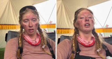 Severely Injured After Everest Climb, 17YO Teen Sparks Online Debate: “Why Take The Risk?”