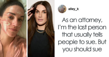 “She Ruined Me”: Woman Claims $90,000 Repairs After Celebrity Facialist “Permanently Disfigured” Her