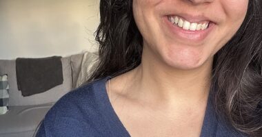 The 'before' selfe: While I've never suffered from acne, apart from the occasional PMS zit, I was taken aback by how tired my skin looked - especially around the eyes