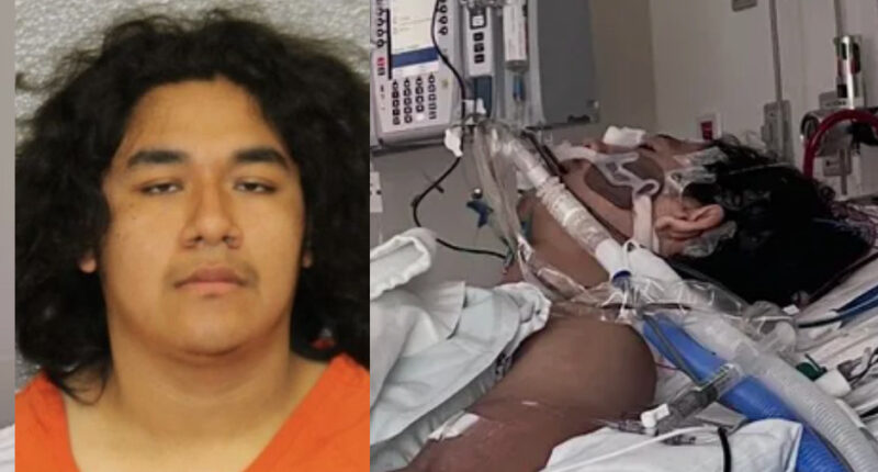 Teen Shot in the Face by ‘Friend’ Who Brought Guns to Sleepover