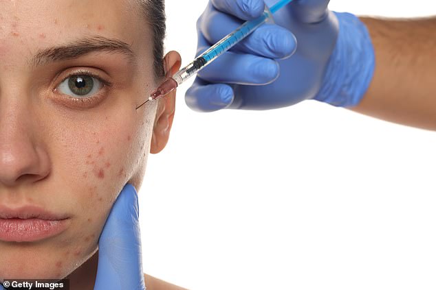 While most grow out of acne by their mid-20s, at least 3 per cent are still affected by it well into their 30s and beyond