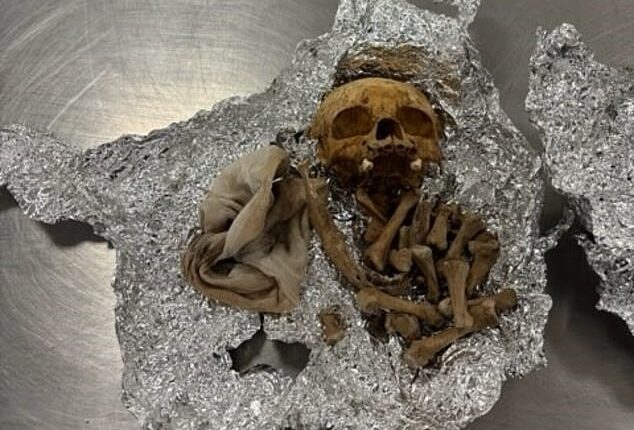 What appeared to be human remains, including part of a skull, were discovered by airport officials when a passenger tried taking them through customs