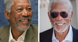 Veneers Before And After: Photos Of 15 Celebrities With The Most Dramatic Smile Makeover
