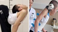 ‘Folded Boy’ Who Was Bent At 180 Degrees For Most Of His Life Stuns With ‘Magical’ Transformation