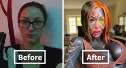 20 Ordinary Lives Changed By Extreme Plastic Surgery