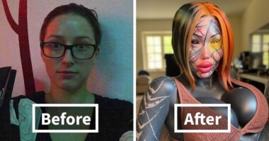 20 Ordinary Lives Changed By Extreme Plastic Surgery