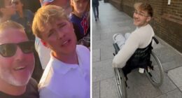 20-Year-Old Decided To Amputate His Leg After Going To A Rock Concert, Breaks His Silence On Why