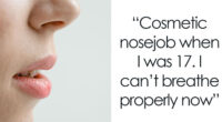 45 Times People Realized They Shouldn’t Have Gotten A Cosmetic Procedure Done