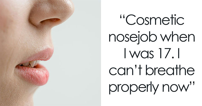 45 Times People Realized They Shouldn’t Have Gotten A Cosmetic Procedure Done