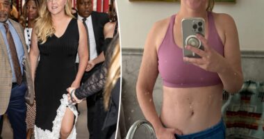 Amy Schumer models flat abs after dramatic weight-loss transformation