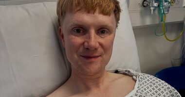 BBC star Owain Wyn Evans has revealed he is taking time off work to recover after undergoing surgery to remove his gallbladder