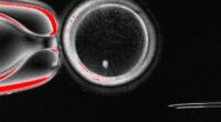 Experts from Oregon Health & Science University have created fertilizable eggs from human skin cells for the very first time