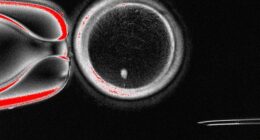 Experts from Oregon Health & Science University have created fertilizable eggs from human skin cells for the very first time