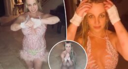 Britney Spears suffers gruesome knee injury after falling down stairs