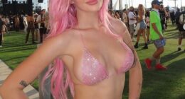 Denise Richards and Charlie Sheen's daughter Sami Sheen has revealed all the work she has had done to look like her supermodel self