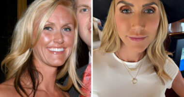 Early Years To Maga Star: Lara Trump “Before And After” Photos Explained