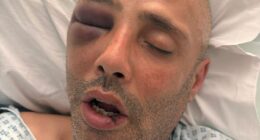 Pictured: Mohamed Ressum, 44, in hospital with life-changing injuries following a collision with a Forest e-bike