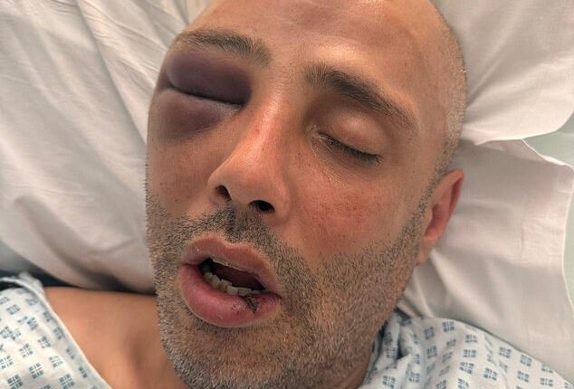 Pictured: Mohamed Ressum, 44, in hospital with life-changing injuries following a collision with a Forest e-bike