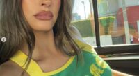 Hailey Bieber candidly opened up about what cosmetic procedures she's had performed on her face