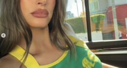 Hailey Bieber candidly opened up about what cosmetic procedures she's had performed on her face